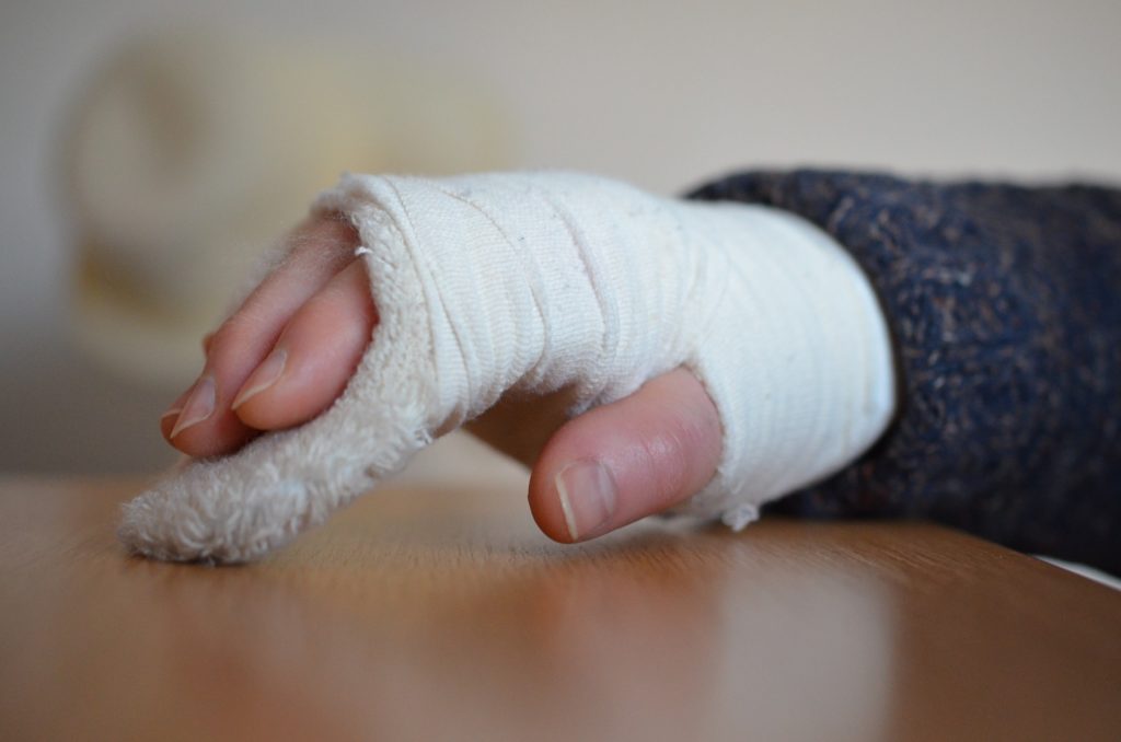 was tun wenn es unter dem gips juckt